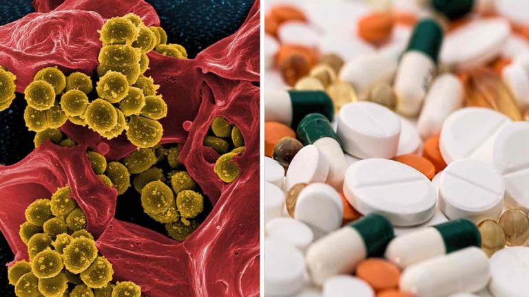 resistenza agli antibiotici
