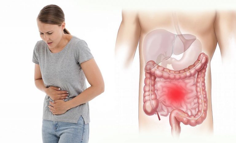 gastroenterite